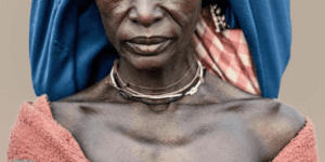 Image of an elderly woman.